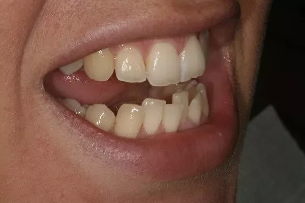 Patient case 1: before treatment