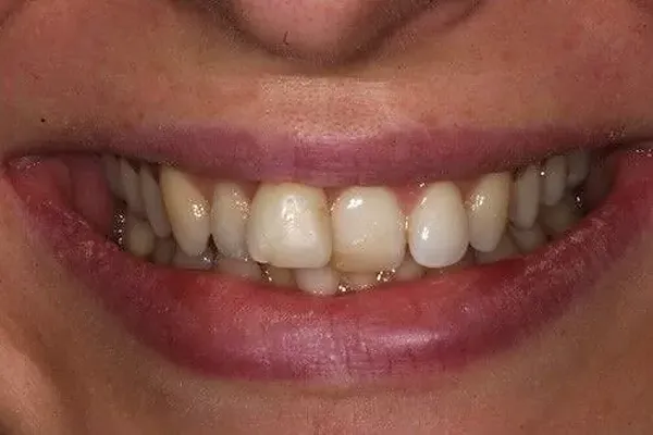 Patient case 2: before treatment