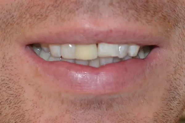 Patient case 3: before treatment