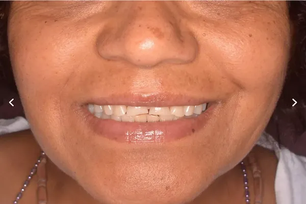 Patient case 4: before treatment